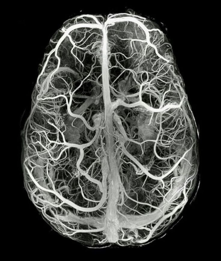 뇌·신경 신경계 MRI 영상