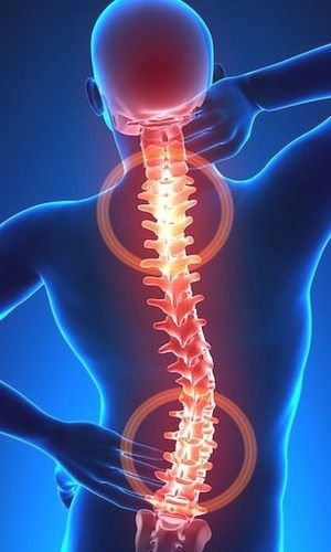 근골격·척추 척추관절 MRI